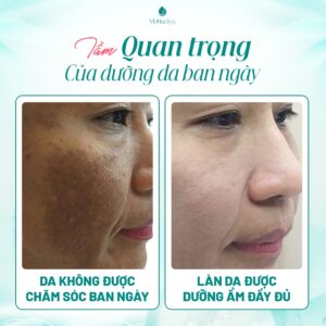Tầm quan trọng của dưỡng da ban ngày