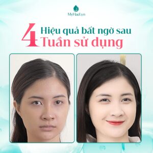 Hiệu quả trẻ hóa làn da vượt trội