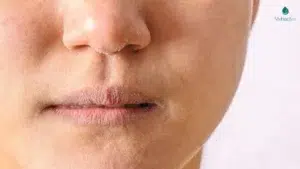 Serum cấp ẩm nano collagen phù hợp với làn da khô