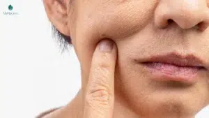 Serum chống lão hóa nano collagen giúp hạn chế tốc độ lão hóa da