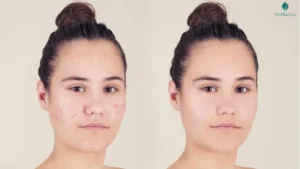 Dưỡng trắng da an toàn, hiệu quả với viên uống collagen nano