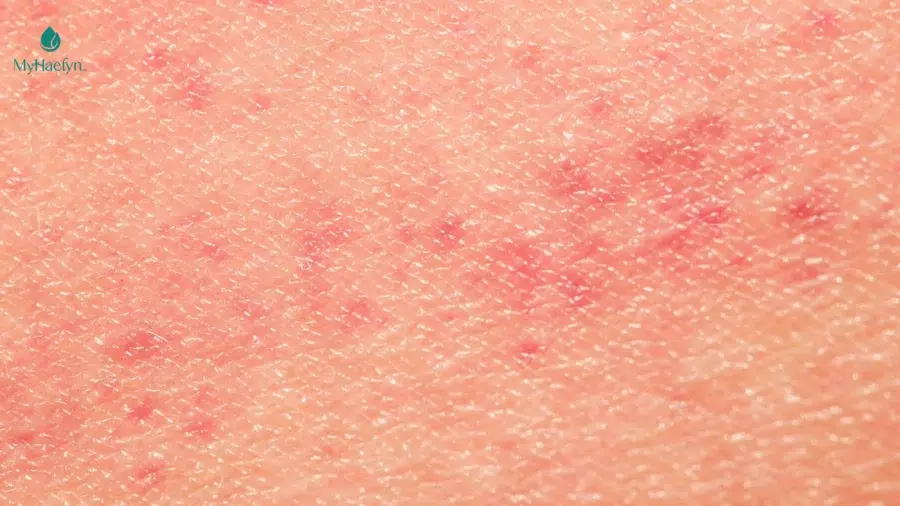 Hậu quả khi sử dụng viên uống trắng da kém chất lượng