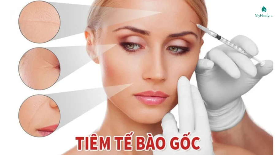 Phương pháp tiêm tế bào gốc NMN vào cơ thể