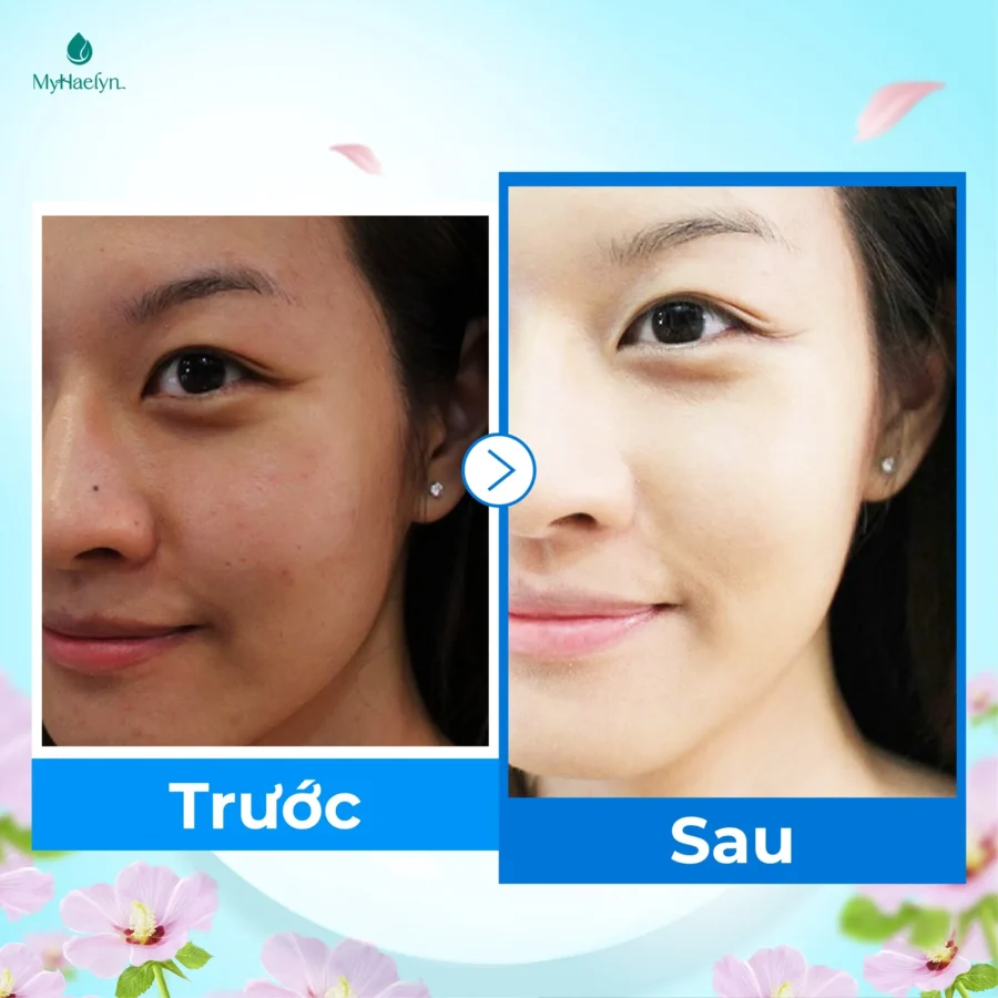 Làn da được cải thiện rõ rệt sau một thời gian ngắn sử dụng serum