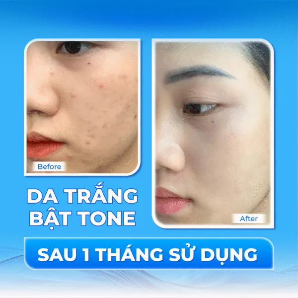 Sở hữu làn da trắng sáng, mịn màng cùng kem dưỡng cao cấp Deoproce