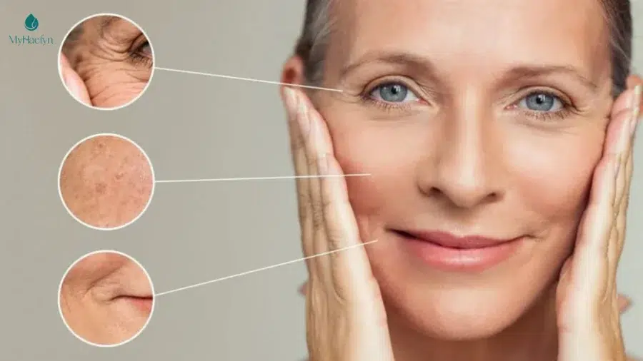 Công thức NMN đột phá giúp làm mờ nếp nhăn hiệu quả