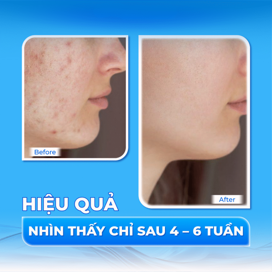 Hiệu quả vượt trội chỉ sau vài tuần