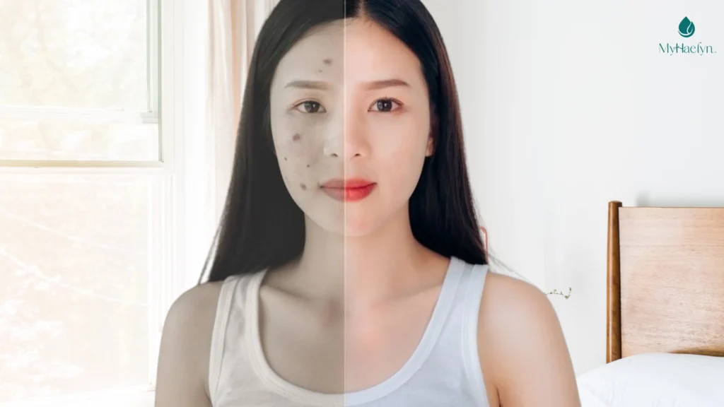 Thời Điểm Vàng Uống Glutathione Giúp Da Đẹp, Dáng Xinh