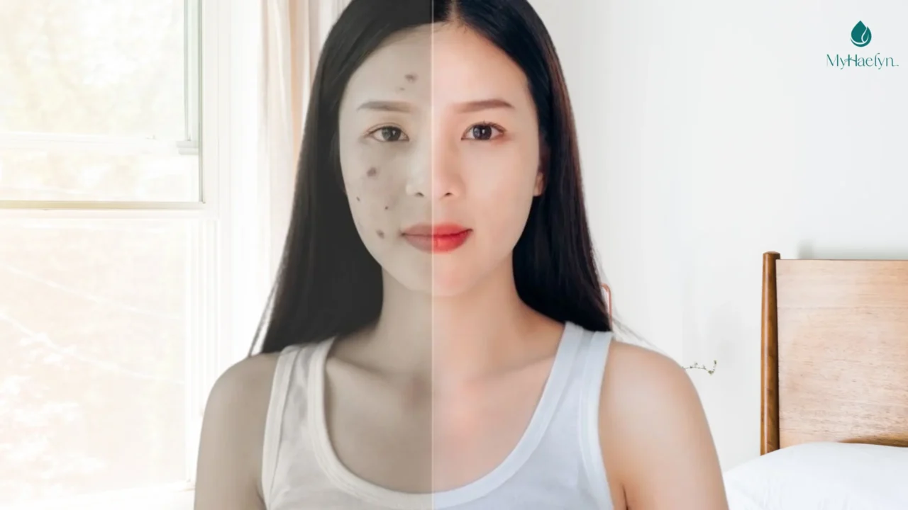 Thi im Vng Ung Glutathione Gip Da p, Dng Xinh - Myhaelyn Vietnam Thi im Vng Ung Glutathione Gip Da p, Dng Xinh - Myhaelyn Vietnam