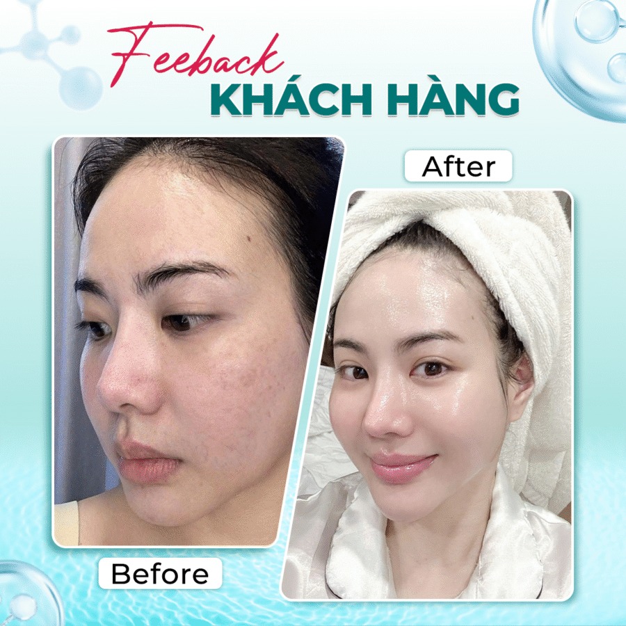 Hướng-dẫn-sử-dụng-Toner-NMN-Exo