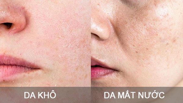Da Mất Nước Và Nhanh Xuống Cấp